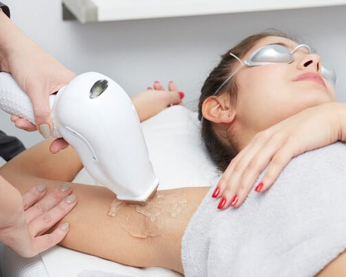 laser_hair_removal