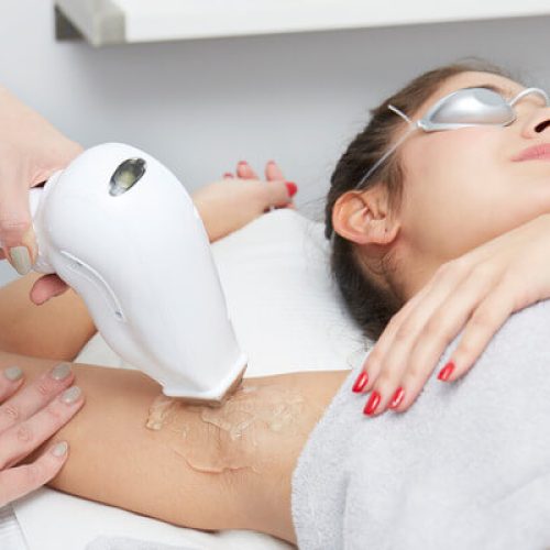 laser_hair_removal