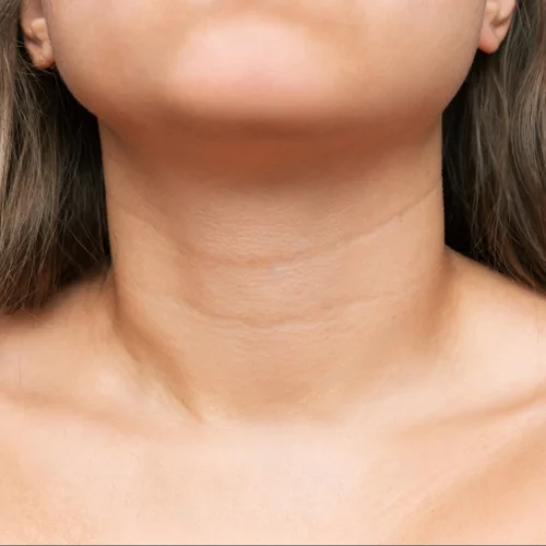 neck_lines-transformed