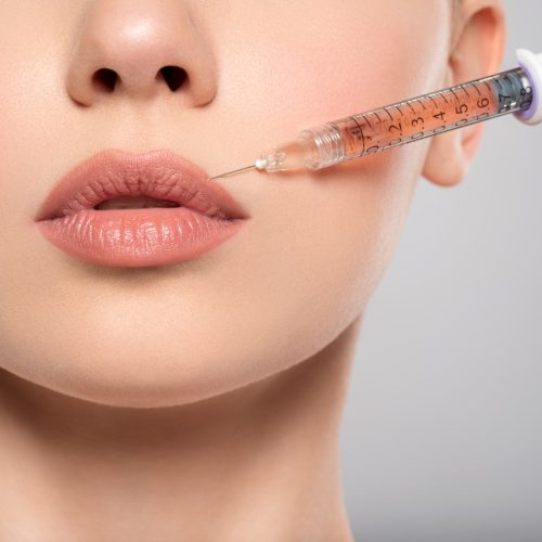 lip-filler